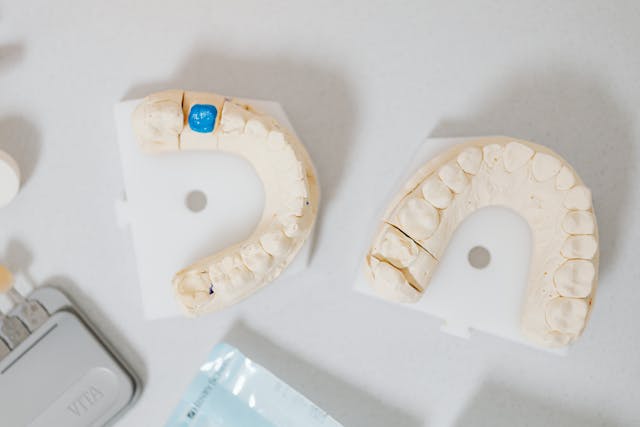 Dental filling treatment